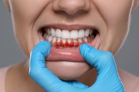 Tooth Sensitivity Treatment